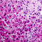 Annexin A6 antibody, LS-C351823, Lifespan Biosciences, Immunohistochemistry paraffin image 