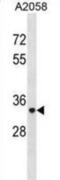 Acid Phosphatase 5, Tartrate Resistant antibody, abx031341, Abbexa, Western Blot image 