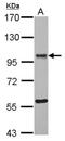 Oxysterol Binding Protein Like 9 antibody, NBP2-19640, Novus Biologicals, Western Blot image 