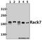 RACK7 antibody, A06830-1, Boster Biological Technology, Western Blot image 