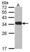 Peptidase Inhibitor 15 antibody, PA5-21888, Invitrogen Antibodies, Western Blot image 