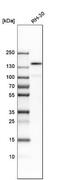 Protein Tyrosine Kinase 7 (Inactive) antibody, NBP1-88157, Novus Biologicals, Western Blot image 