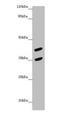 MAGE Family Member B10 antibody, orb36150, Biorbyt, Western Blot image 