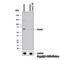 Coactivator Associated Arginine Methyltransferase 1 antibody, NB100-56374, Novus Biologicals, Western Blot image 