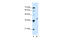 Homeobox D11 antibody, 27-459, ProSci, Western Blot image 