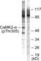Calcium/Calmodulin Dependent Protein Kinase II Alpha antibody, abx012403, Abbexa, Western Blot image 
