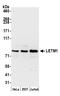 Leucine Zipper And EF-Hand Containing Transmembrane Protein 1 antibody, A305-558A, Bethyl Labs, Western Blot image 