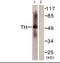 Tryptophan Hydroxylase 1 antibody, orb95561, Biorbyt, Western Blot image 