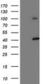 Proteasome 26S Subunit, Non-ATPase 2 antibody, MA5-25624, Invitrogen Antibodies, Western Blot image 