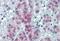 Cellular Repressor Of E1A Stimulated Genes 1 antibody, MBS246008, MyBioSource, Immunohistochemistry paraffin image 