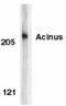 Apoptotic Chromatin Condensation Inducer 1 antibody, GTX27355, GeneTex, Western Blot image 