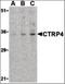 C1q And TNF Related 4 antibody, orb87299, Biorbyt, Western Blot image 