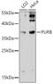 Purine Rich Element Binding Protein B antibody, 18-311, ProSci, Western Blot image 