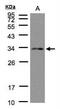 NDC80 Kinetochore Complex Component antibody, NBP1-32281, Novus Biologicals, Western Blot image 