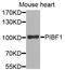 Progesterone Immunomodulatory Binding Factor 1 antibody, A3072, ABclonal Technology, Western Blot image 