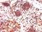Killer cell lectin-like receptor 3 antibody, orb184528, Biorbyt, Immunohistochemistry paraffin image 