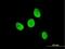 Testis Associated Actin Remodelling Kinase 2 antibody, H00010420-M08, Novus Biologicals, Immunofluorescence image 