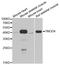 Tropomodulin 4 antibody, A10885, Boster Biological Technology, Western Blot image 