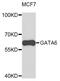 GATA Binding Protein 6 antibody, STJ111832, St John