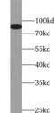 Hyperpolarization Activated Cyclic Nucleotide Gated Potassium Channel 3 antibody, FNab03789, FineTest, Western Blot image 
