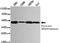 Pyruvate Dehydrogenase E1 Alpha 1 Subunit antibody, MBS475108, MyBioSource, Western Blot image 