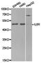 IL-6RA antibody, TA327080, Origene, Western Blot image 