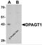 Dolichyl-Phosphate N-Acetylglucosaminephosphotransferase 1 antibody, 6485, ProSci, Western Blot image 