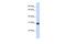 Zinc Finger MYND-Type Containing 19 antibody, A13723, Boster Biological Technology, Western Blot image 