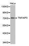 TNF Alpha Induced Protein 3 antibody, LS-C192920, Lifespan Biosciences, Western Blot image 