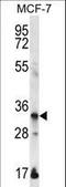 Envoplakin Like antibody, LS-C167852, Lifespan Biosciences, Western Blot image 