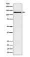 Involucrin antibody, M02628-1, Boster Biological Technology, Western Blot image 