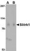 SLIT And NTRK Like Family Member 1 antibody, orb74933, Biorbyt, Western Blot image 