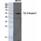 Transforming Growth Factor Beta Receptor 2 antibody, LS-C386401, Lifespan Biosciences, Western Blot image 