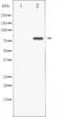 Protein Kinase C Zeta antibody, abx011395, Abbexa, Western Blot image 