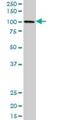 PBX Homeobox Interacting Protein 1 antibody, H00057326-B01P, Novus Biologicals, Western Blot image 