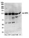 Ubiquitin Specific Peptidase 4 antibody, NB100-2869, Novus Biologicals, Western Blot image 