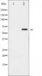 Serine/threonine-protein kinase Chk2 antibody, TA325373, Origene, Western Blot image 