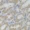 Vasoactive Intestinal Peptide antibody, A12531, ABclonal Technology, Western Blot image 