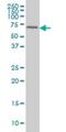 FGR Proto-Oncogene, Src Family Tyrosine Kinase antibody, H00002268-M02, Novus Biologicals, Western Blot image 