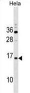 Hydroxyacyl-Thioester Dehydratase Type 2 antibody, abx030733, Abbexa, Western Blot image 