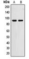 Zinc Finger Protein 227 antibody, orb214757, Biorbyt, Western Blot image 