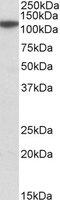 Methylenetetrahydrofolate Dehydrogenase (NADP+ Dependent) 1 Like antibody, MBS422729, MyBioSource, Western Blot image 