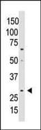 Cellular Communication Network Factor 5 antibody, PA5-13232, Invitrogen Antibodies, Western Blot image 