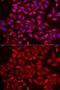 Signal Recognition Particle 19 antibody, GTX33519, GeneTex, Immunocytochemistry image 