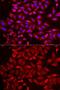 Signal recognition particle 19 kDa protein antibody, GTX33519, GeneTex, Immunocytochemistry image 