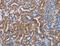 ALG12 Alpha-1,6-Mannosyltransferase antibody, LS-C401218, Lifespan Biosciences, Immunohistochemistry frozen image 