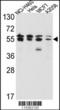 Inosine Monophosphate Dehydrogenase 2 antibody, MBS9213404, MyBioSource, Western Blot image 
