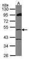 Zinc Finger And SCAN Domain Containing 21 antibody, GTX104915, GeneTex, Western Blot image 