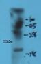 Sonic Hedgehog Signaling Molecule antibody, GTX37548, GeneTex, Western Blot image 