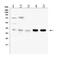 ARPC1B antibody, A07192-2, Boster Biological Technology, Western Blot image 